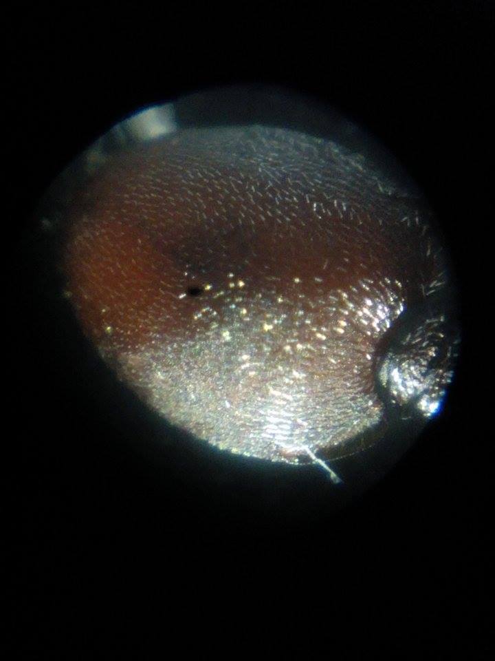 cephalotes abdomen
