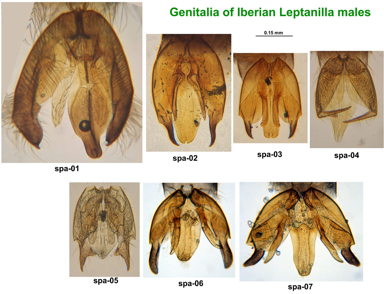 Genitalia of Iberian Leptanilla males