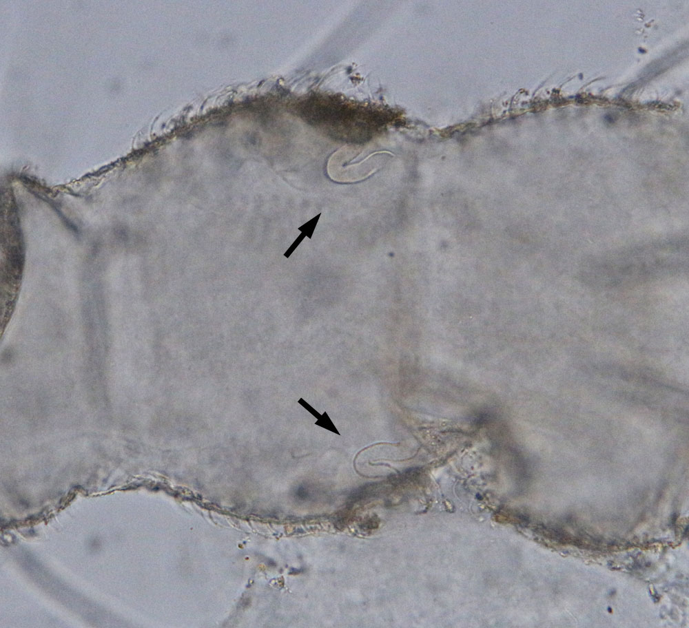 �rgano exudatorio de hemolinfa-larva Leptanilla sp-Madrid-1