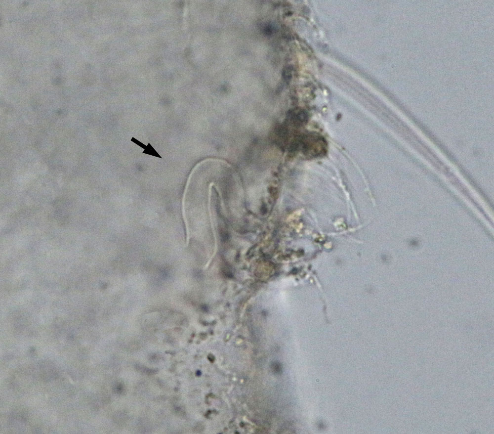 �rgano exudatorio de hemolinfa-larva Leptanilla sp-Madrid-2