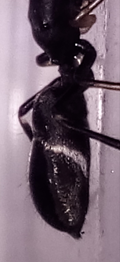 abdomen-araa
