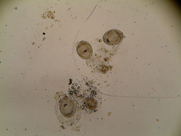 Cisticercoides, foto de xeg.