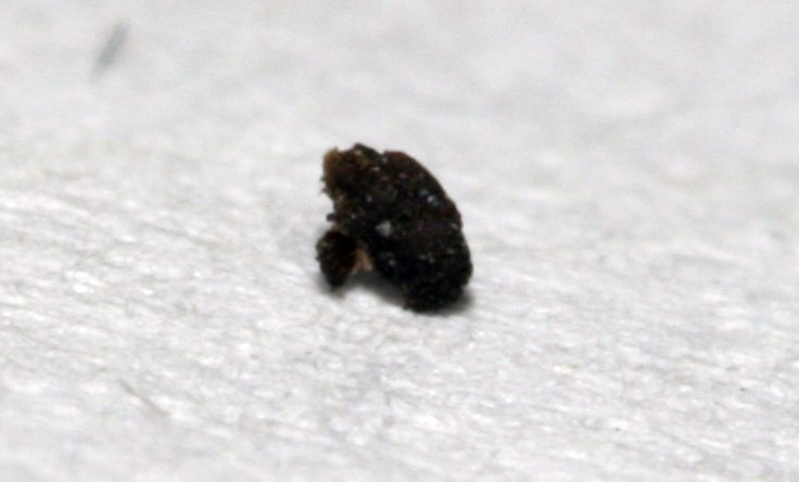 Hongo de Camponotus?