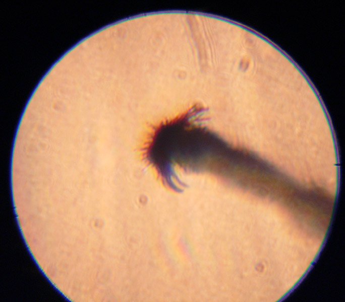 pata de tapinoma (microscopio)