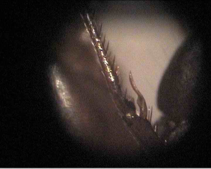 foto de la extremidad de una hormiga de Iglesiaz.