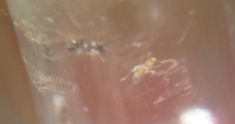 recien nacida
