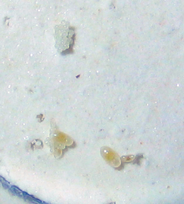 Huevos y larvas de Pheidole pallidula