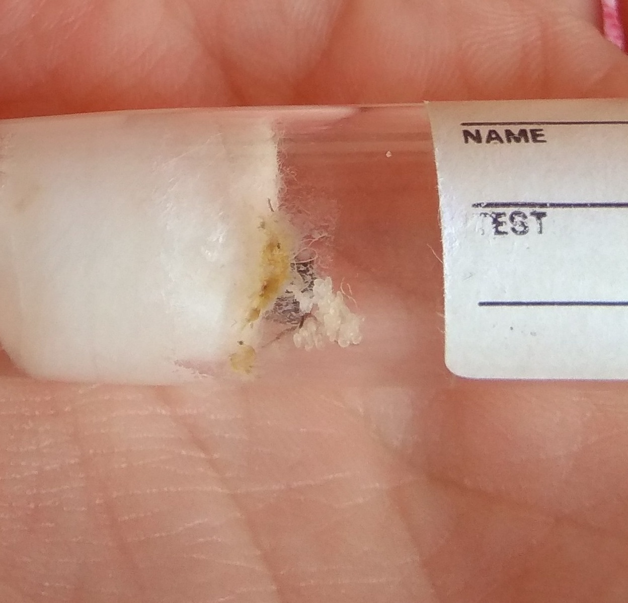 Lasius niger