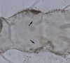 Órgano exudatorio de hemolinfa-larva Leptanilla sp-Madrid-1