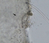 �rgano exudatorio de hemolinfa-larva Leptanilla sp-Madrid-2