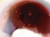 Nurse de Camponotus