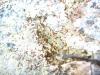 Pheidole sp.?