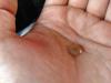 thumb IMG 0983 1024