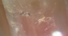 recien nacida